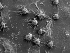 Pomohou rakovinové buňky odhalit tajemství nesmrtelnosti?