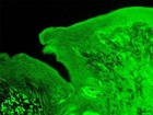 Část jazyka krysy, na kterém je zelenou barvou označen receptor, reagující na kalcium