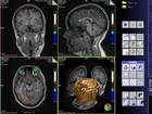 Magnetická rezonance (MR, MRI; Tomografie z řec.. τόμος „řez, výřez“ a γράφειν „malovat psát“) je zobrazovací technika používaná především ve zdravotnictví k zobrazení vnitřních orgánů lidského těla. 
