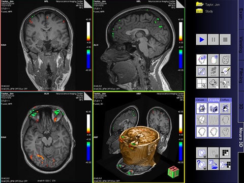 Magnetická rezonance (MR, MRI; Tomografie z řec.. τόμος „řez, výřez“ a γράφειν „malovat psát“) je zobrazovací technika používaná především ve zdravotnictví k zobrazení vnitřních orgánů lidského těla. 