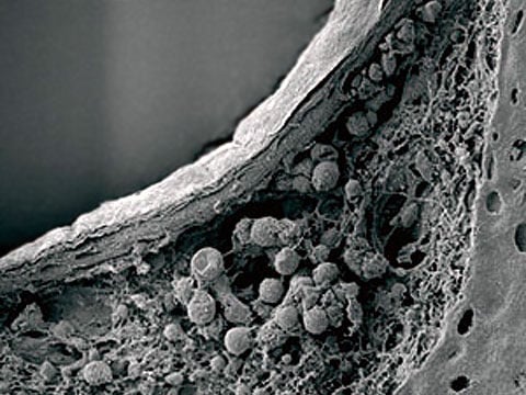 Nervový uzel Gruenberga (Grueneberg ganglion), objevený už v roce 1973