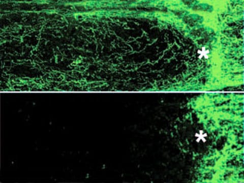 Poškozené axony zrakového nervu u normální myši (dole) a regenerované u myši po genové terapii