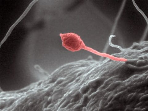 Vybarvená fotografie houby Gliocladium roseum, získaná na skenovacím elektronovém mikroskopu